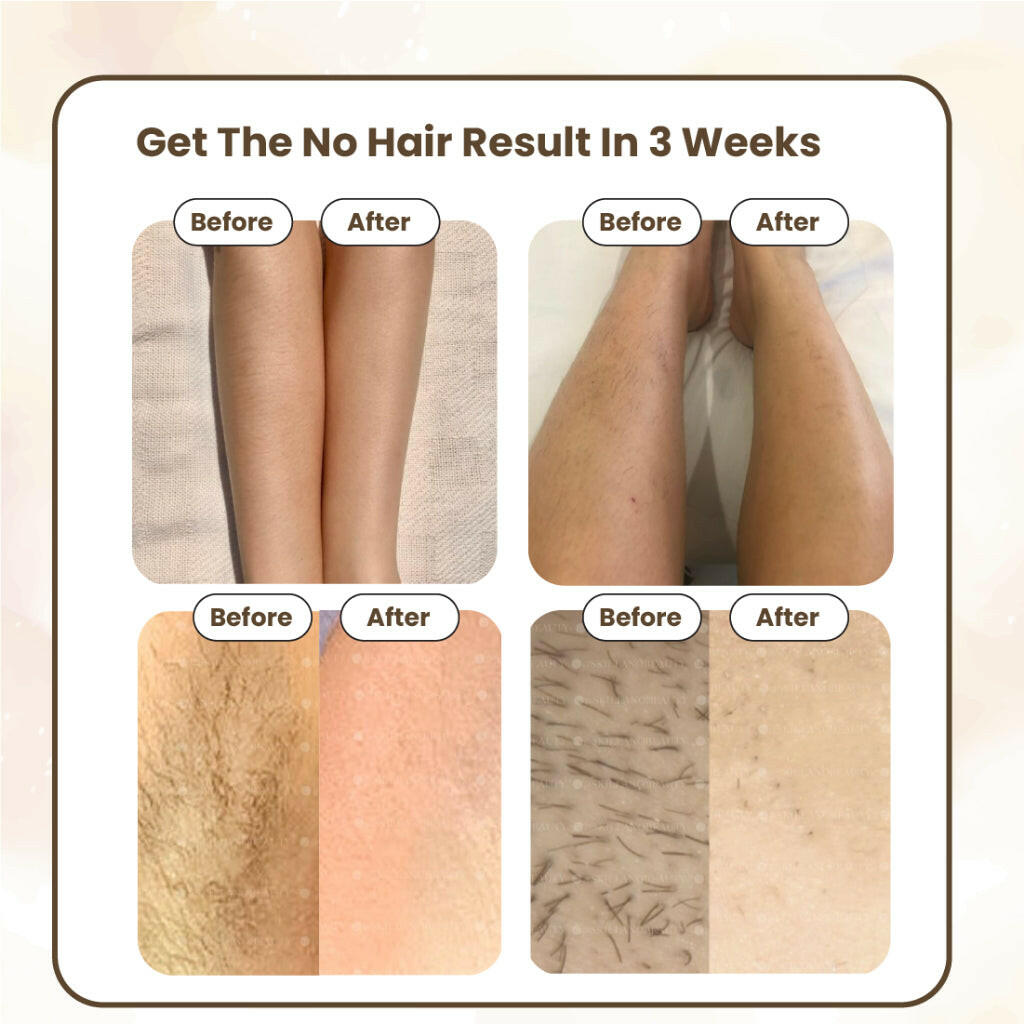 Skillano Pro Diamond IPL Laser Hair Removal - Skillano Beauty PTE LTD