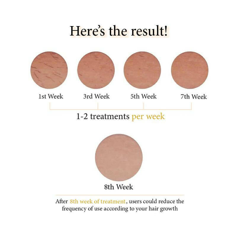 Skillano Premium IPL Laser Hair Removal - Skillano Beauty PTE LTD