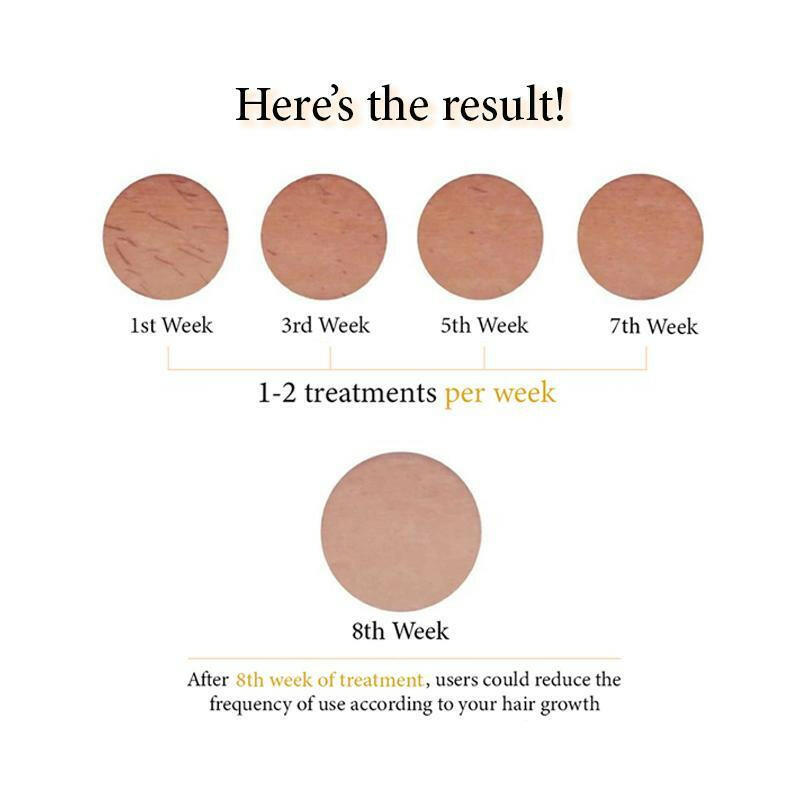 Skillano Pro IPL Laser Hair Removal - Skillano Beauty PTE LTD