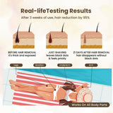 Pro Ice IPL Permanent Hair Removal Device - Skillano Beauty PTE LTD